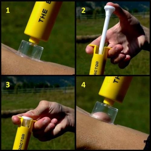 Set gegen Bisse Sawyer Bite & Sting Kit